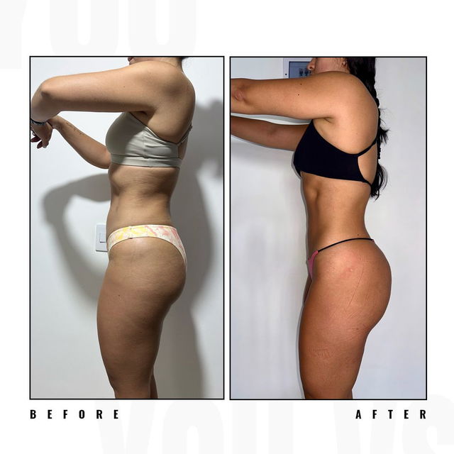 Transformation before after