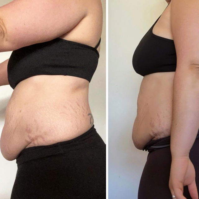 Transformation before after