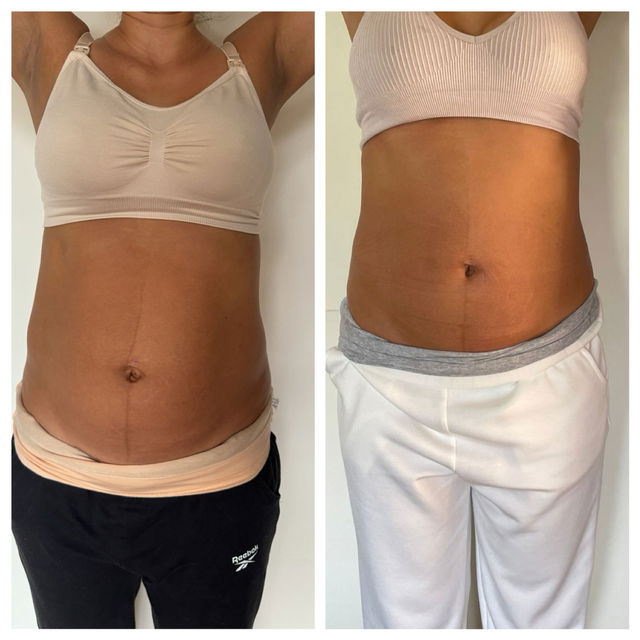 Transformation before after