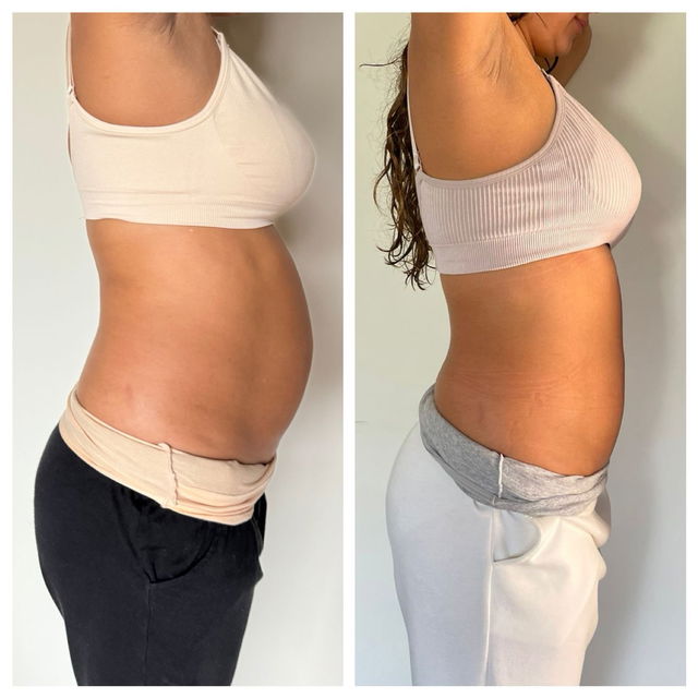 Transformation before after