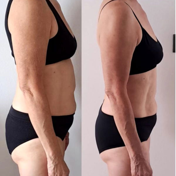 Transformation before after