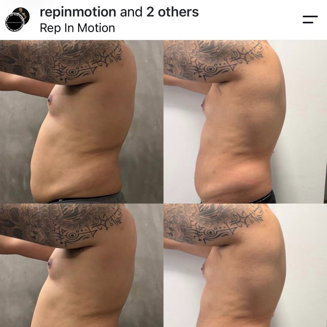 Transformation before after