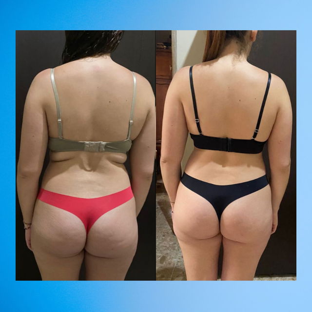 Transformation before after