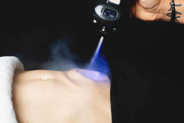 CryoSlimming Contour & Define Package