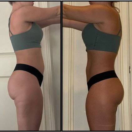 Transformation before after